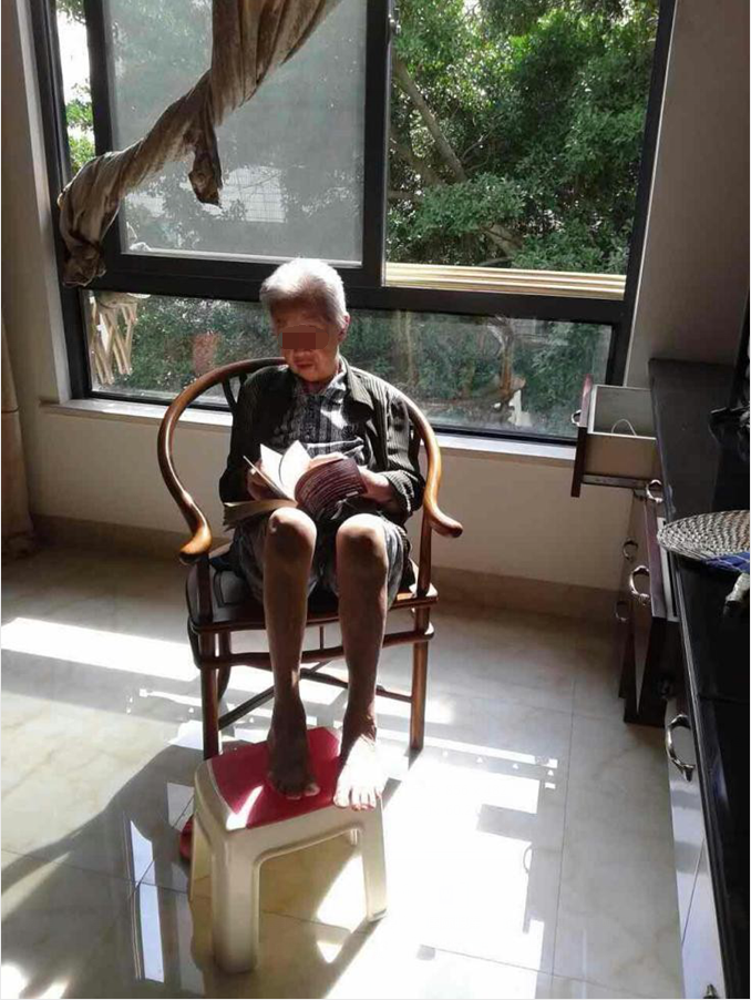 白內障,白內障手術