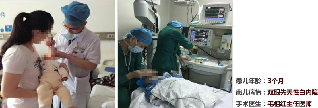 患兒年齡：3個月，患兒病情：雙眼先天性白內(nèi)障，手術(shù)醫(yī)生：毛祖紅主任醫(yī)師
