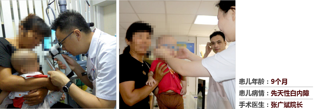 患兒年齡：9個月，患兒病情：先天性白內(nèi)障，手術(shù)醫(yī)生：張廣斌院長