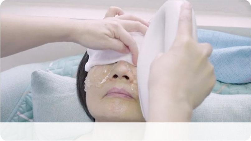 OPT強脈沖光治療