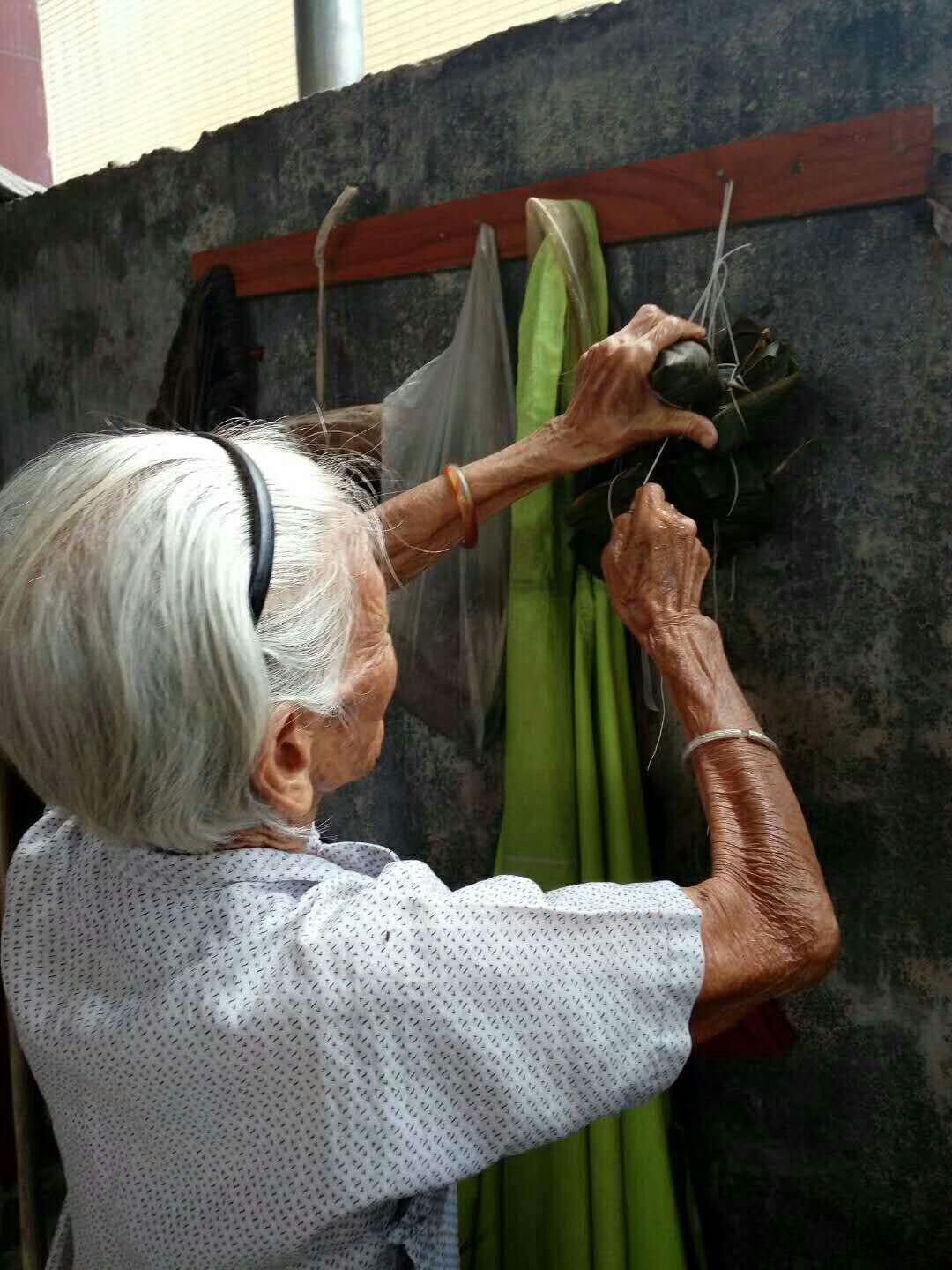 百歲阿婆做白內障手術