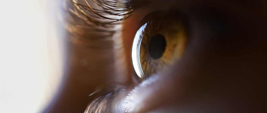 白內(nèi)障癥狀